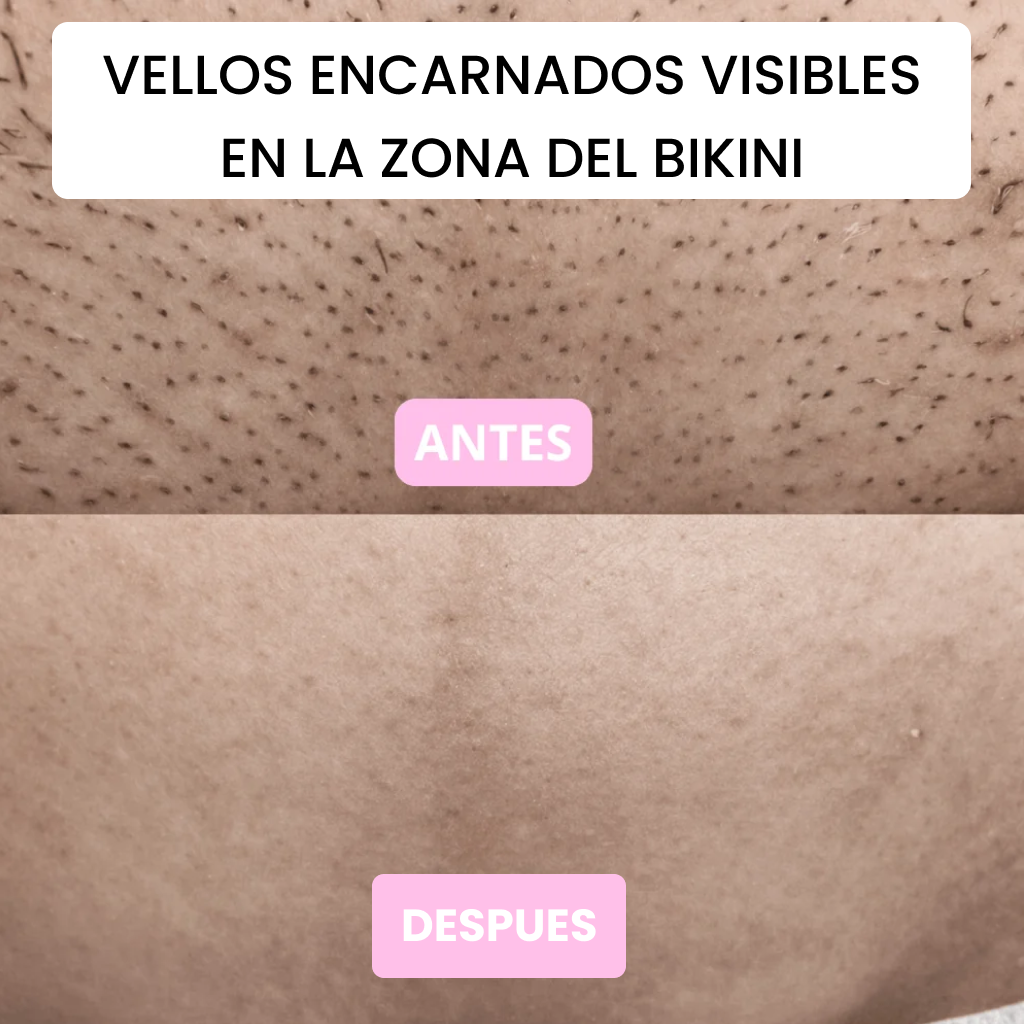 Depiladora íntima 2 en 1 - Suave y Precisa