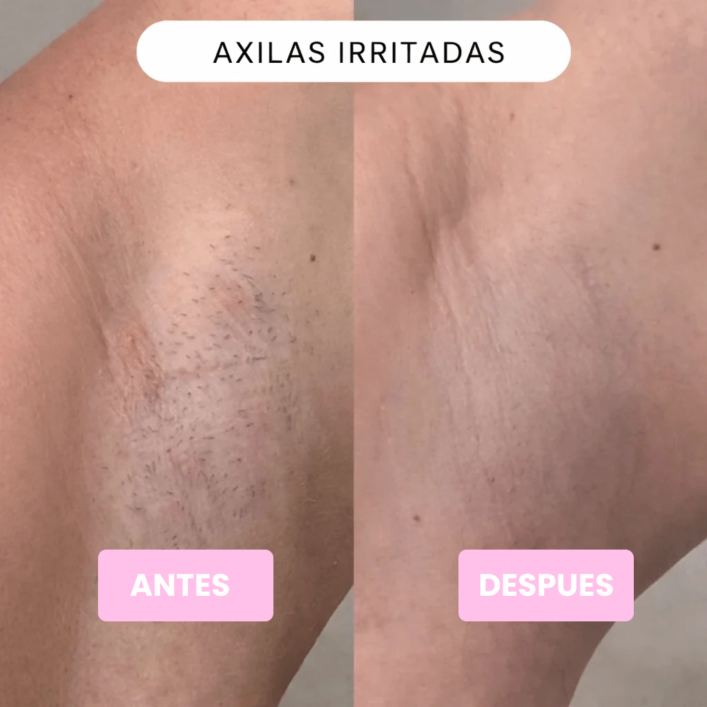 Depiladora íntima 2 en 1 - Suave y Precisa